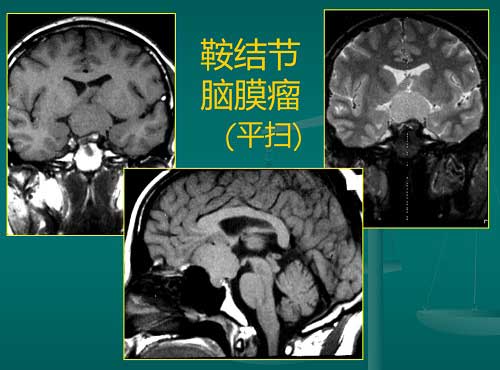 石家庄真仁中医钩活术总医院.jpg