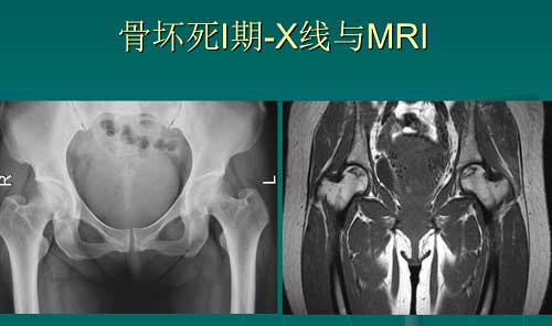 石家庄真仁中医钩活术总医院.jpg