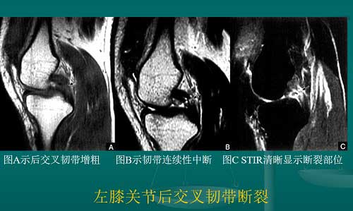 石家庄真仁中医钩活术总医院.jpg