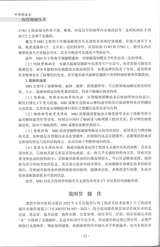 中华钩活术钩活骨减压术(理论与操作第四节)