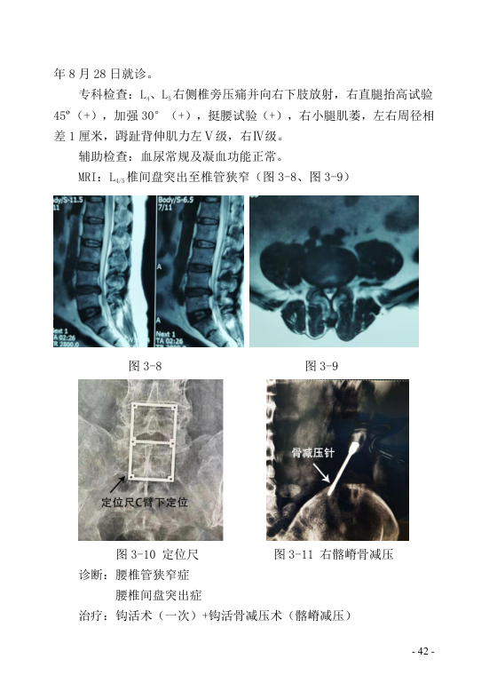 中医钩活术技术(自出）转出第53页.jpg
