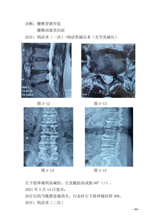 中医钩活术技术(自出）转出第55页.jpg