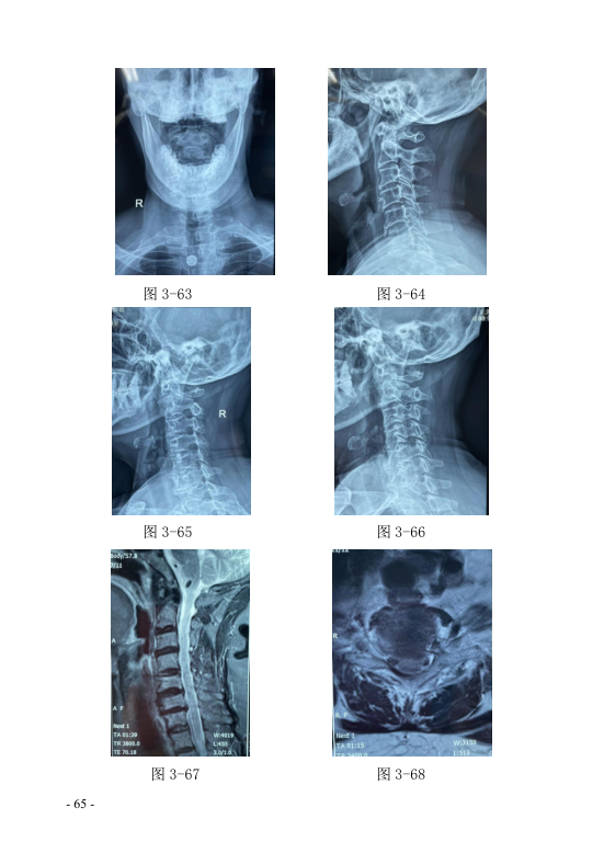 中医钩活术技术(自出）转出第76页.jpg