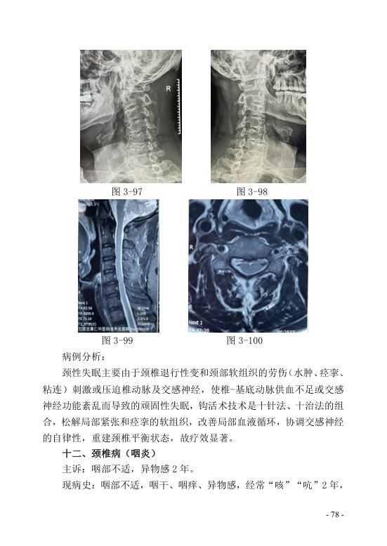 中医钩活术技术(自出）转出第89页.jpg