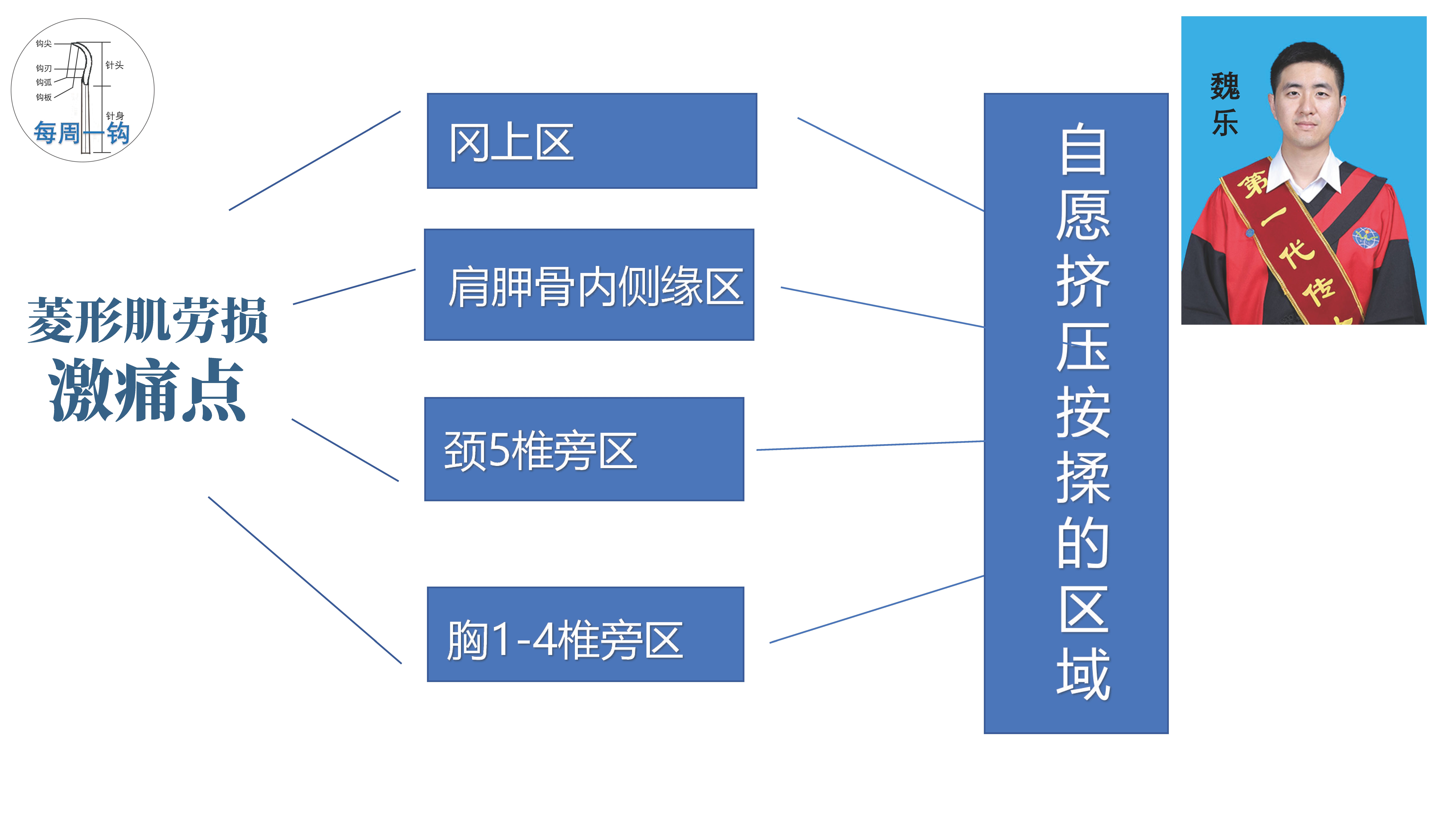 菱形肌劳伤钩活术临床操作研究（魏乐主任）_页面_22.jpg