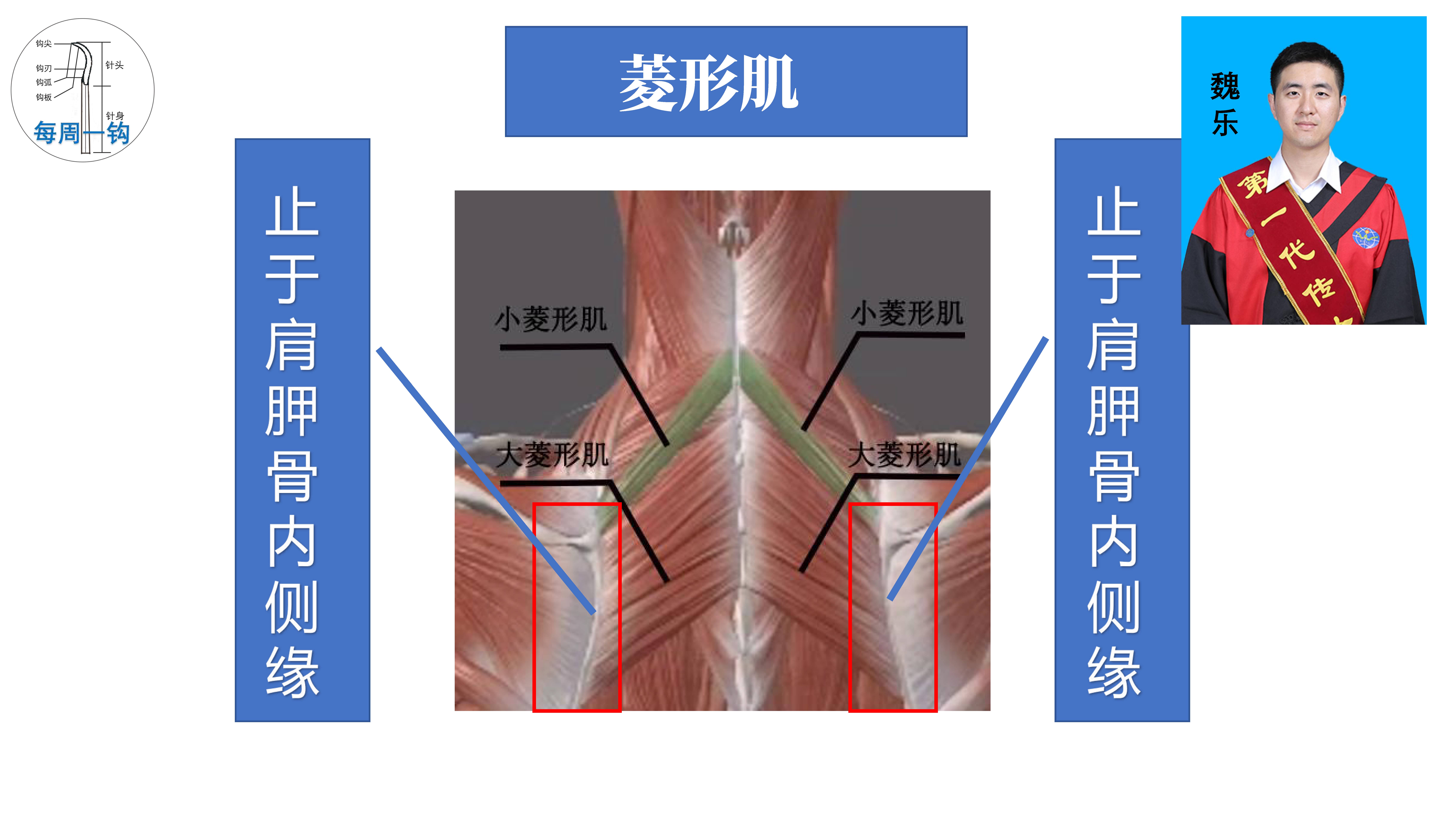 菱形肌劳伤钩活术临床操作研究（魏乐主任）_页面_07.jpg